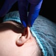 What to Know About Earlobe Reconstruction Surgery